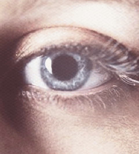 Eye
