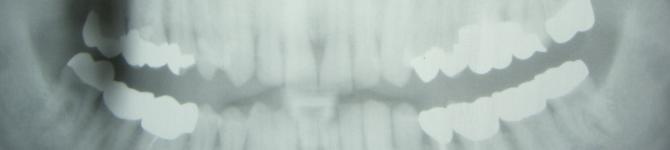 header