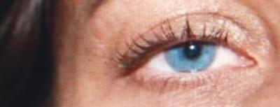 auge-1