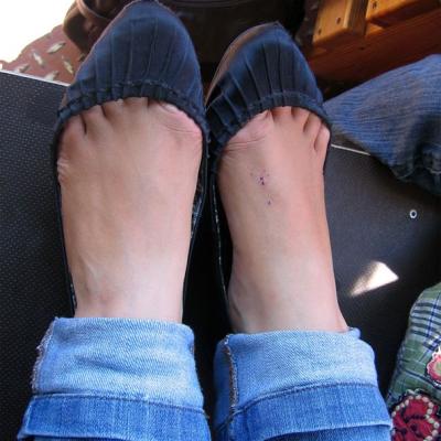 Geschundene-Fuesse-IMG_4897