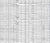 EEG