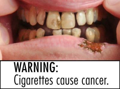 zigaretten-verursachen-krebs-foto-us-food-and-drug-administration-