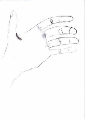 Hand7