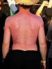 Sonnenbrand-Tattoo
