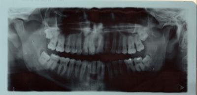 Das sind sie, meine vier kleinen Freunde. Das sind sie, meine vier kleinen Freunde.