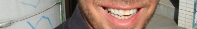 nachher