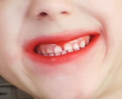 Ein roter Popstickel und das Kind hörte nicht mehr auf zu glucksen :D