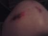 knie