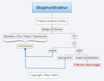 Skaphoidfraktur
