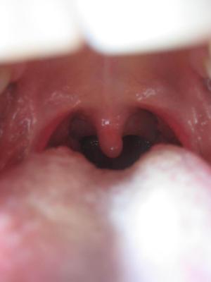 uvula