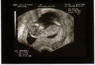 Ultraschall-13-6