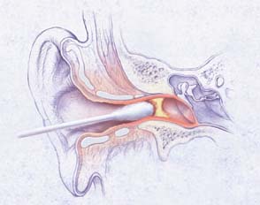 anatomie des ohrenputzens