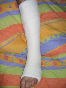 gips