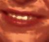 Mund