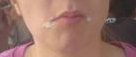 mund